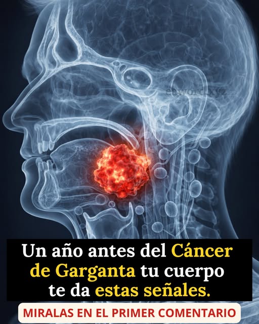 Señales tempranas del cáncer de garganta: los síntomas que muchas personas pasan por alto