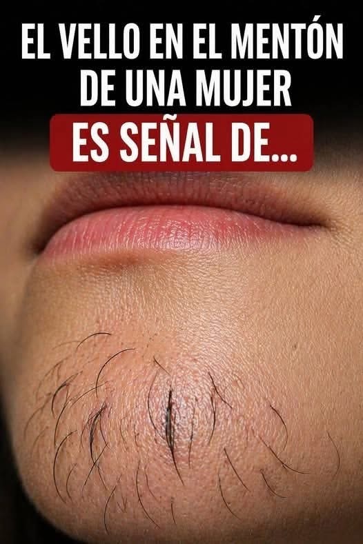 ¿Qué significa tener vello en el mentón siendo mujer? Causas, cuándo es normal y cuándo consultar al médico