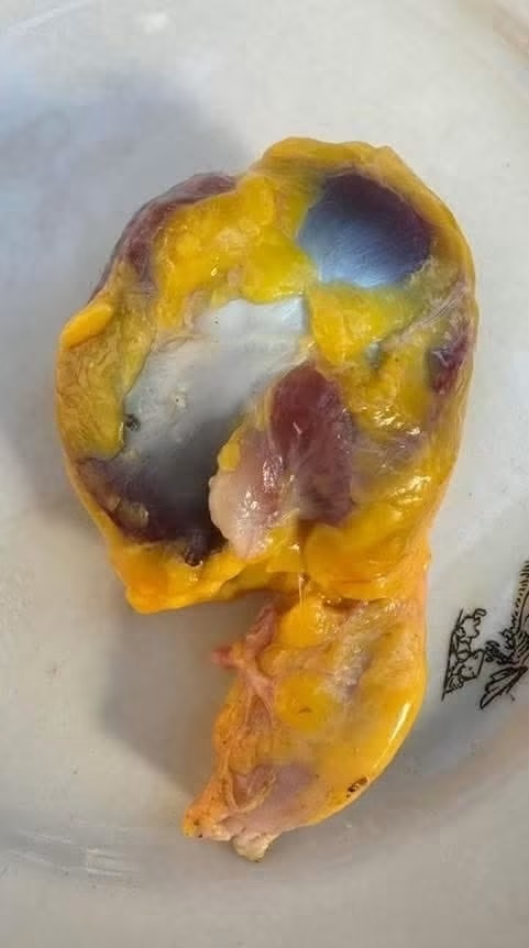 ¿Es saludable comer molleja de pollo? Beneficios reales, riesgos y lo que dice la ciencia