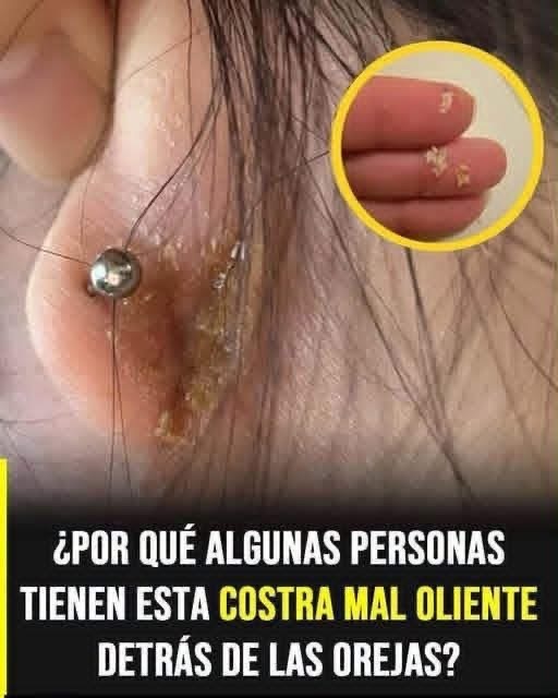 Por qué aparecen costras detrás de las orejas? Causas, síntomas y cuándo consultar al médico