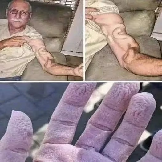 Dolor repentino en el brazo y cambios en la piel: qué puede significar y cuándo buscar atención médica