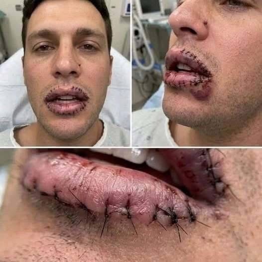 Lesiones y puntos en los labios: posibles causas, cuidados y señales de alerta