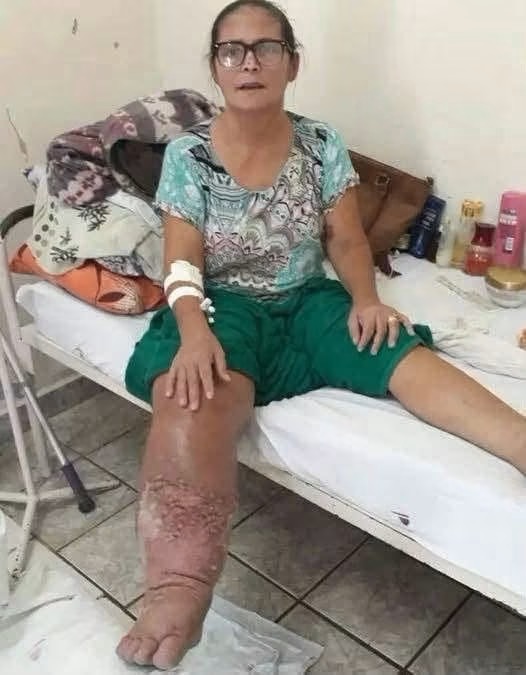 ¿Dormir con “algo” puede dejar una pierna así? La imagen viral no demuestra esa causa