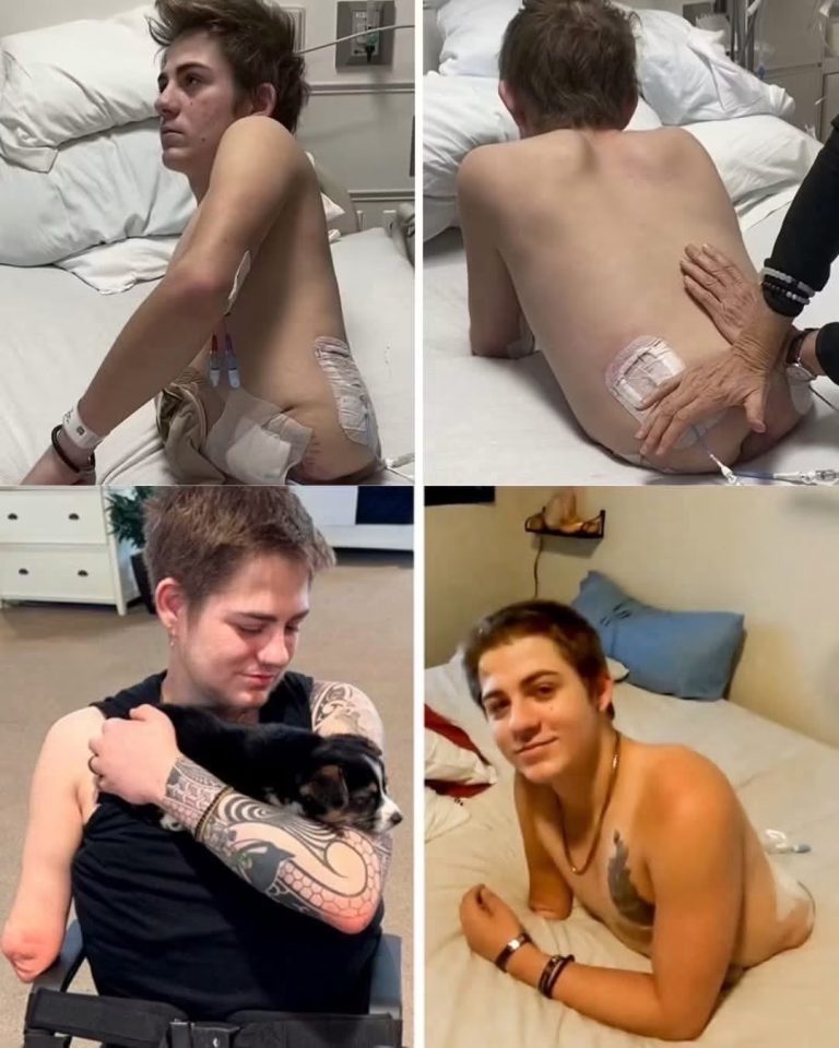 Loren Schauers: el joven que sobrevivió tras perder la mitad inferior de su cuerpo en un accidente