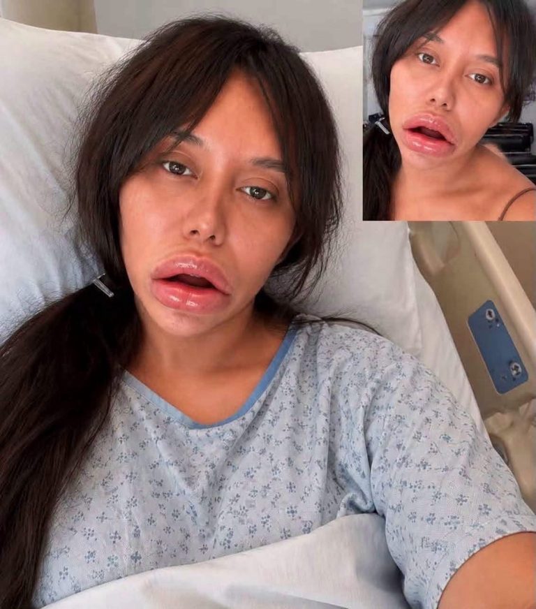 Publicación sobre una joven tabasqueña genera alerta por un presunto procedimiento estético