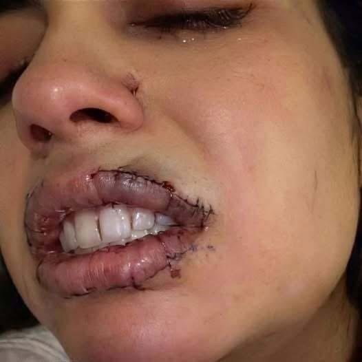 Una joven sufrió un terrible incidente y su historia deja una profunda reflexión