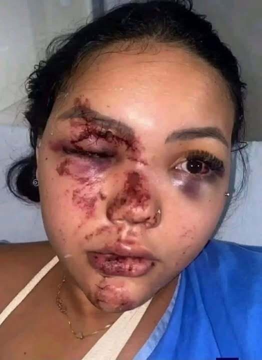 UNA FOTOGRAFÍA DE UNA MUJER LESIONADA SE VOLVIÓ VIRAL… PERO LA HISTORIA NO ESTABA CONFIRMADA
