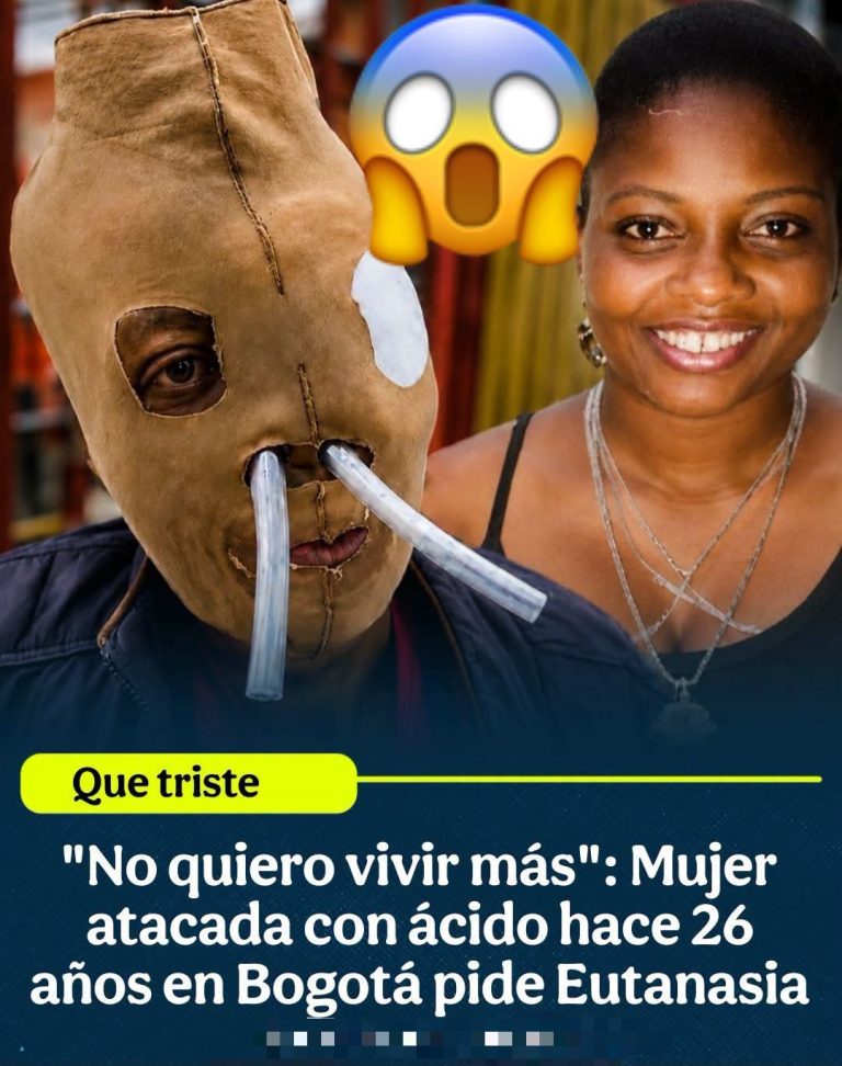 María Consuelo Córdoba enfrenta las secuelas de un ataque con ácido y pide ayuda para continuar su tratamiento